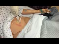 LVAD Driveline dressing change demonstration