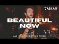 Zedd - Beautiful Now ft. Jon Bellion (Vaskan Hardstyle Remix)