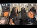 Alopecia Braid Cover up Braid tutorial for Beginner Braiders
