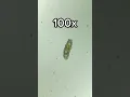 Download Lagu Tardigrade at 0x, 40x, 100x and 400x magnification!