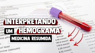 Aprenda a interpretar o HEMOGRAMA de forma FÁCIL
