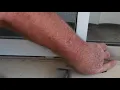 Adjustable Fit Sliding Patio Screen Door Installation