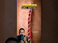 Download Lagu Proses Penyembuhan Luka Jahitan. #shorts #education #science #biology
