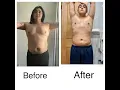 Liposuction Post-Op 3 weeks update