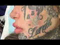 AMBER LUKE FACE TATTOO REMOVAL x 3