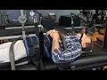 Durham NC Chiropractor Sciatica treatment