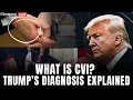 Download Lagu LIVE: Trump Diagnosed with Chronic Venous Insufficiency That Causes Swollen Legs