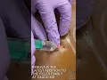 RENUVA FOR HIPS - KAADO MD
