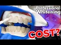 How Much Does Professional Teeth Whitening Cost