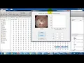 DWT based endoscopic Image Compression MATLAB