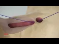 Channel