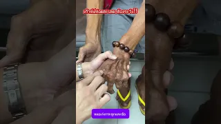 เก๊าทมานาเป็นโรคอะไร และเกิดจากสาเหตุใด