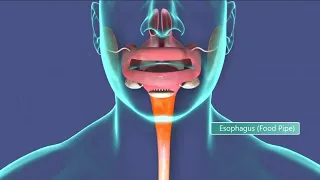 In-depth Esophageal cancer symptoms to look for and why it kills most who are diagnosed with it