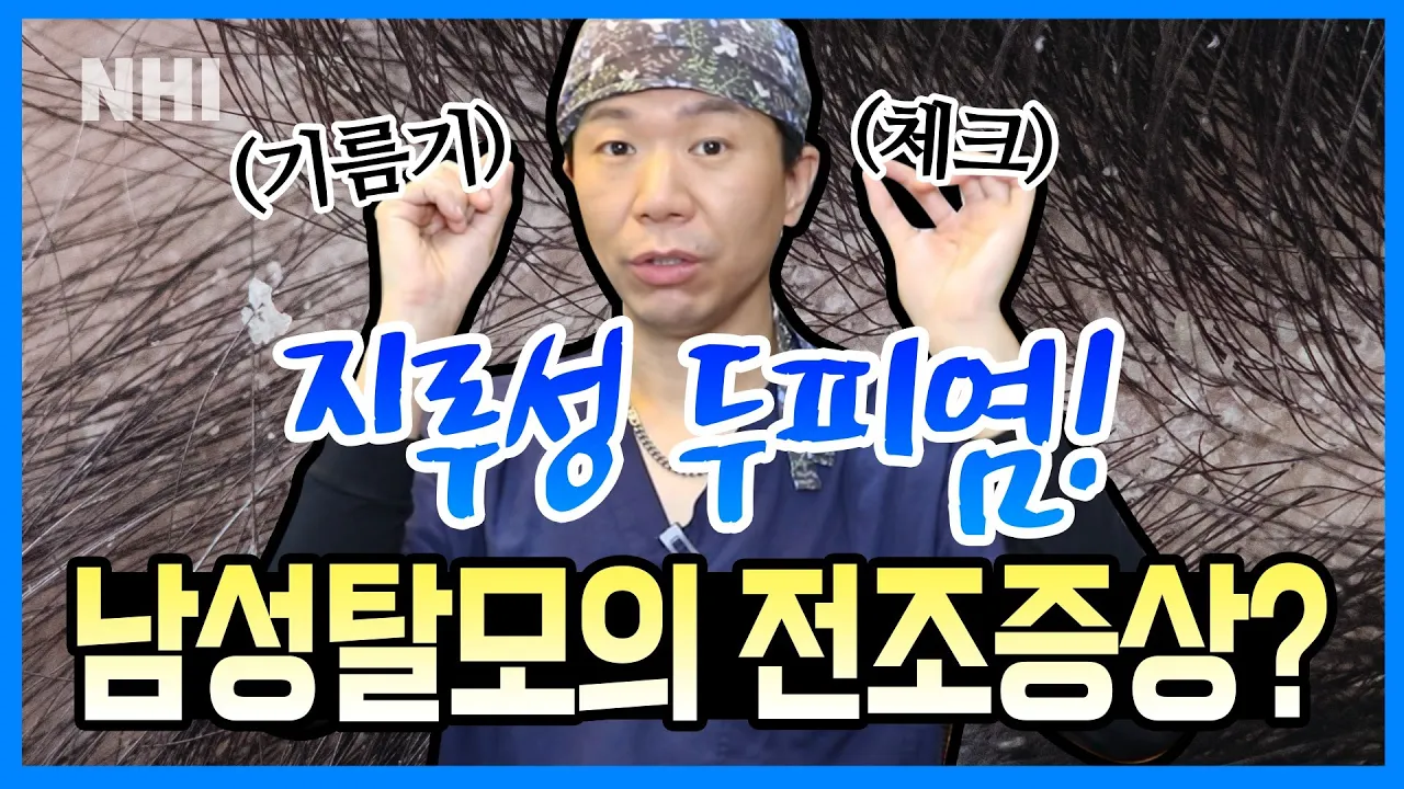 지루성 두피염이 남성탈모의 전조 증상?ㅣ뉴헤어