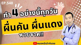 ผื่นคันและผื่นแดงที่ไม่หายสักที มีสาเหตุหลักมาจากอะไรบ้าง