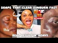 Best Treatment Soaps For Clearing skin sensitive skin Edition