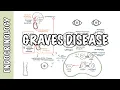 Grave s Disease
