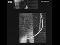 Fascination - Buzz Kull
