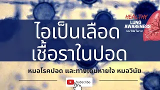 เชื้อราในปอดคืออะไร และเกิดขึ้นได้อย่างไร
