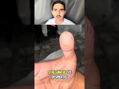 ¡TEN CUIDADO SI TU MANO SE PUSO ASÍ! 😱😳 ib: @secretoscuriososs