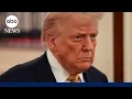 Download Lagu Trump diagnosed with chronic venous insufficiency, White House says