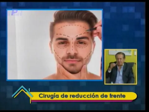 Estética al Día: Cirugía de reducción de frente 