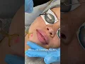 Laser Treatment at Bared Monkey NYC