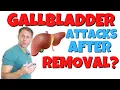 Phantom Gallbladder Attacks After Gallbladder Removal