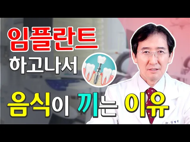 임플란트 치료 후 음식이 끼는 이유