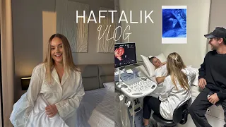 Bebeğimizi Kontrole Götürdük  (Ayakları Aynı Halil 👶🏻🪽) | Evde Yılbaşı Gecesi 🎄 I Haftalık Vlog