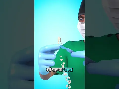 नाक काटने के बाद आप को क्या करना चाहिए 😞😱 #shortsviral #youtubeshorts #shorts