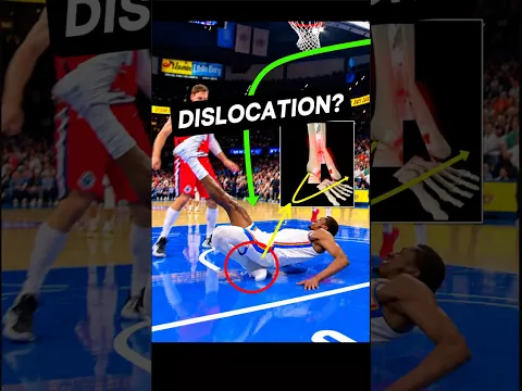 Jalen Williams GRAPHIC Ankle Injury — Doctor Explains