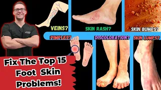 Download Top 15 Foot Skin Problems [Toenail Fungus, Dry Skin \u0026 More] MP3