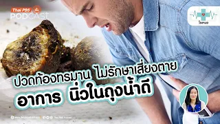 ทำไมการไม่รักษา_nิ่วในถุงน้ำดีถึงอันตราย