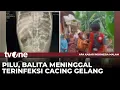 Download Lagu Balita Terinfeksi Cacing Gelang Meninggal Dunia Usai Dirawat Selama 8 Hari | AKIM tvOne