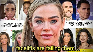 CONGRATULATIONS, YOUR FACELIFT FAILED...