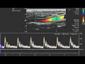 Power Doppler Ultrasound - High-Sensitivity Blood Flow Imaging and Signal Analysis