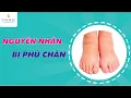 Download Lagu Vì sao bạn bị phù chân? Làm sao cho hết?