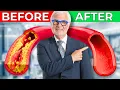 Unclog Your Arteries Naturally With These 5 Foods Recommended By A Heart Surgeon