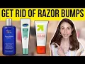 HOW TO GET RID OF RAZOR BUMPS Dermatologist DrDrayzday