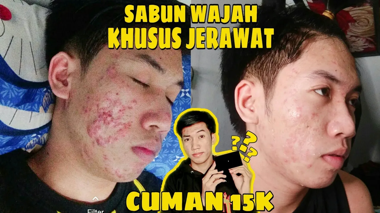 Di Video Kali Ini Aku Bakal Merekomendasikan Beberapa Face Wash Pria Terbaik Untuk Mengatasi Kulit B. 