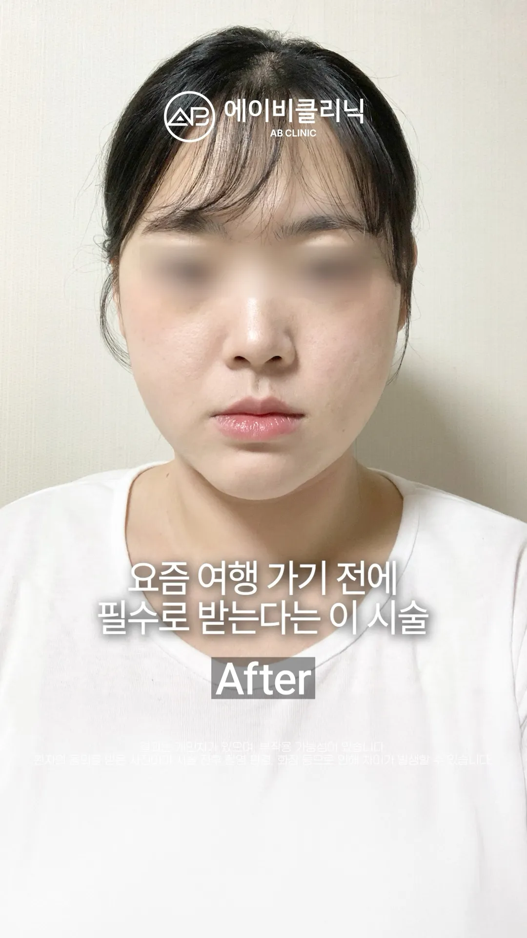 여행가서 인생샷 건지고 싶다면 에이빼하세요 ✨