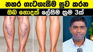 කකුල් වල නහර ගැටගැසීම (Varicose) සුව කරන ප්‍රායෝගික රහස් 3ක්