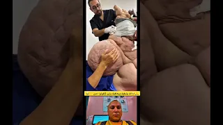 الله يشفيه ويعافيه يارب قولوا آمین I Pray For This Man God Bless You Allah الله Shorts 