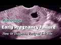 Early Pregnancy Failure - Miscarriage Ultrasound diagnosis at 5 6 wks