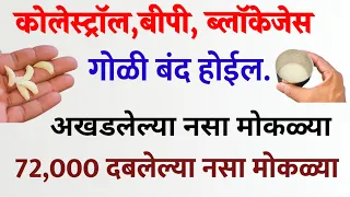 आखडलेल्या दबलेल्या नसा मोकळ्या होतील फक्त 21 दिवस करा हा  उपाय डॉ कृष्णा #trend #ghargiti_upachar 