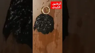 الزئبق الكبدي عش الخفاش عجيييييب 