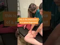 Myofascial release treatment when it s been over 6 months and you ve had no relief