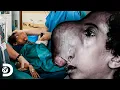 Download Lagu Menina fica com rosto deformado devido a um tumor nasal | Meu Corpo, Meu Desafio | Discovery Brasil
