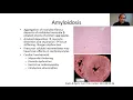 Download Lagu Cardiac Amyloidosis by Dr. Amrut Ambardekar (11/20/20)